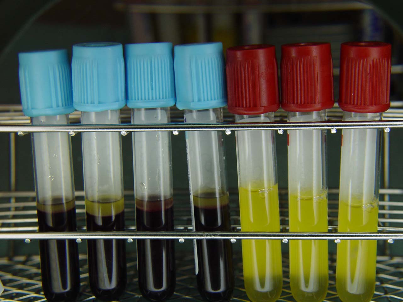 Tubos de ensayo ya centrifugados y a punto de inocular
